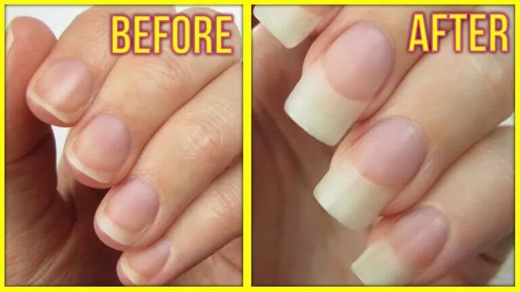Endurecedor de Uñas 7 Days X 3 Unidades